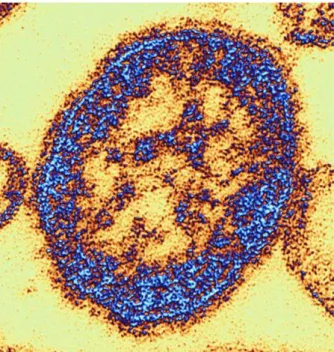 Figure 1 : Schéma du virus morbilleux (5)          Figure 2 : Virus de la rougeole au microscope                                                      électronique (6) 