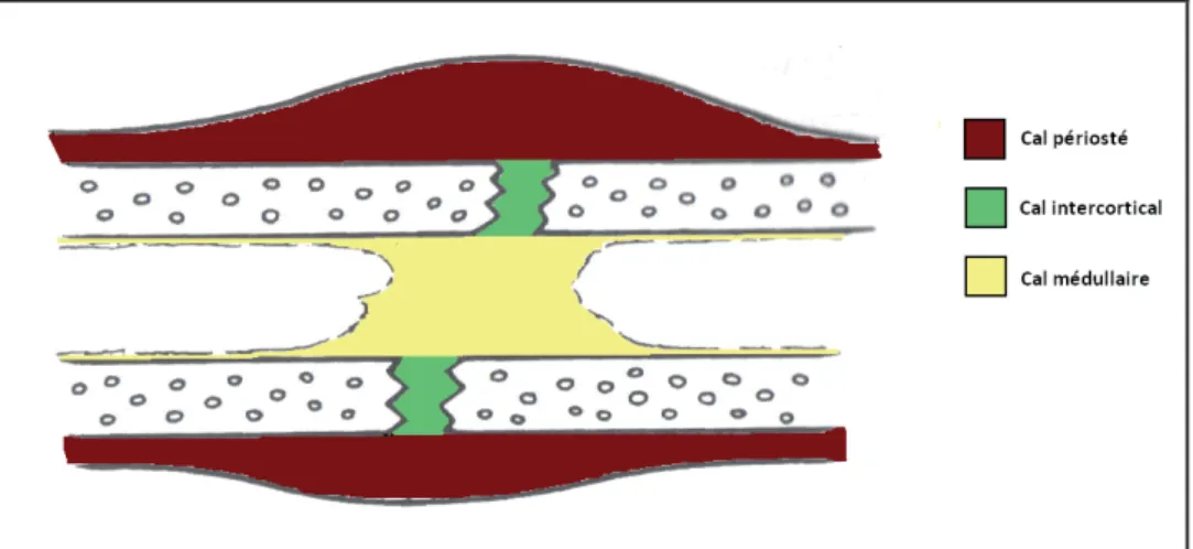 Figure 2 : Structure histologique d’un cal de fracture [57]