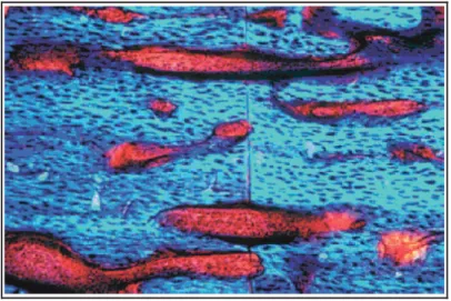 Figure 3 : Apparence histologique de la cicatrisation osseuse primaire (le trait d’ostéotomie central est  chevillé par de nouveaux ostéons, colorés en rouge, qui fabriquent directement de l’os lamellaire) d’après Perren 
