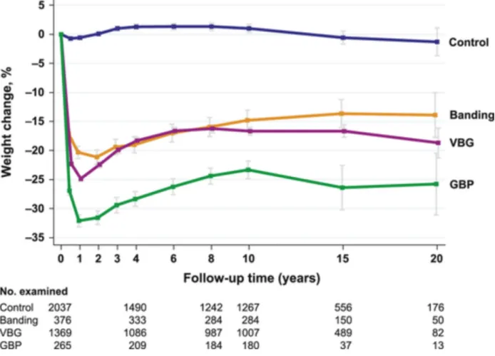 Figure 3 : Courbe d'évolution du poids dans le temps selon l'étude Swedish Obese Subjects  Control : groupe témoin ; Banding : groupe anneau gastrique ; VBG : groupe gastroplastie verticale 