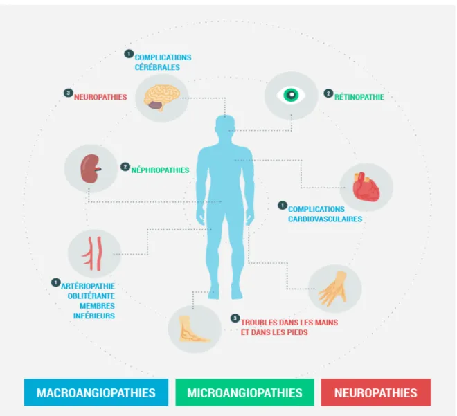 Illustration 6: Principales conséquences du diabète(5)