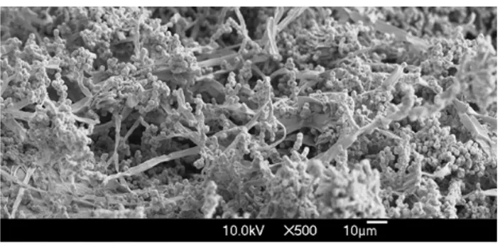 Figure 1  Scanning electron micrograph of Penicillium verrucosum on wheat