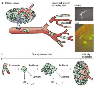 Fig. 1-3: The metastatic process from the primary site to the secondary site  [8] . 