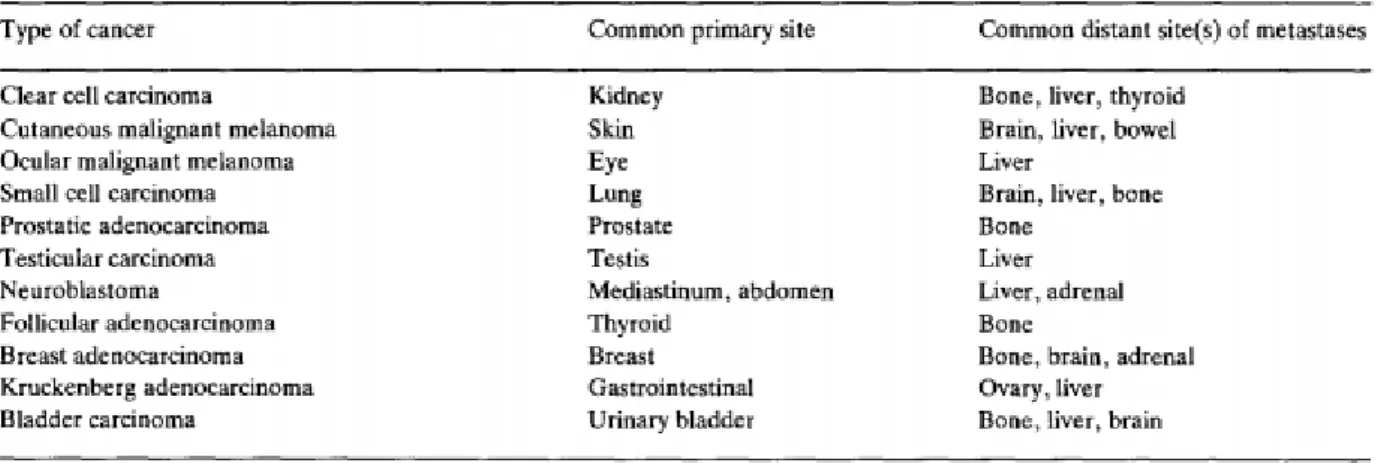 Fig. 1-4: Examples of metastatic pattern which cannot be explained by the pattern of blood  flow in the body  [10] 