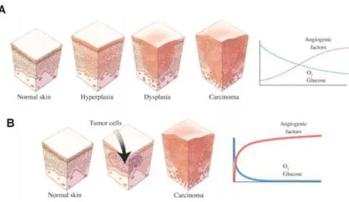 Fig. 1-5: Steps and effects in the development of (A) spontaneous cancer (B) transplanted  cancer  [30] 