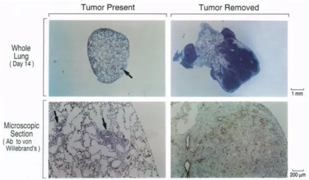 Fig. 1-6: Influence of the presence of the originally transplanted tumors on the growth of its  metastasis and of the related angiogenesis (Blue staining: tumors, brown staining: new 