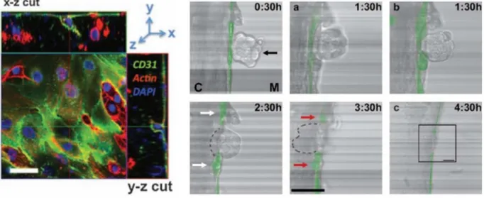 Fig. 1-9: (Left) Migration of endothelial cells (Green Staining) towards Tumors (Red  staining) during angiogenesis and driven by hypoxia, scale bar 50 μm  [47]  (Right) Migration 