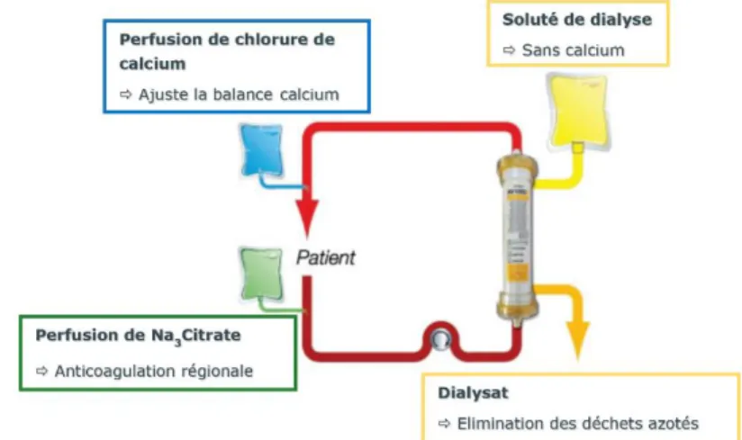 Figure 2 : Anticoagulation loco-régionale au citrate