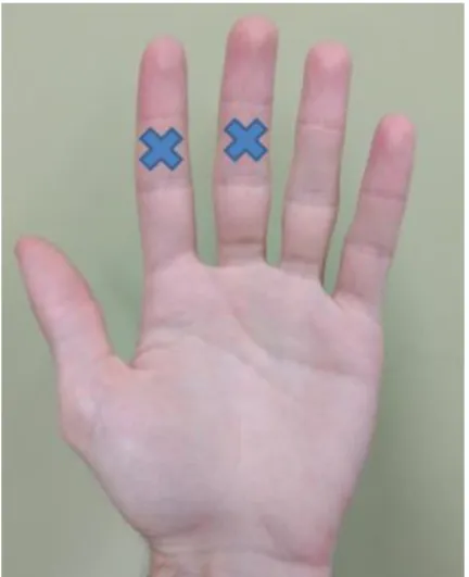 Figure 5 : Positionnement des électrodes électrodermales. 