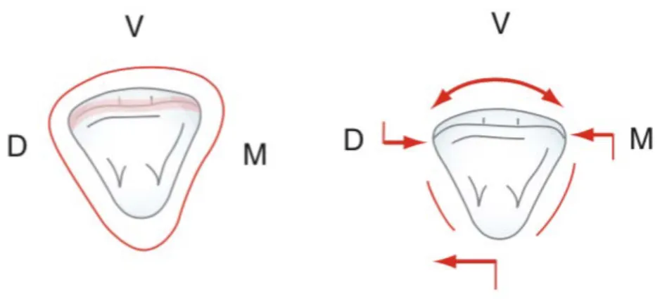 Figure 6 : Vues de la face incisale de l’incisive latérale maxillaire  [ 43 ]