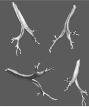 Figure 1.4  Reconstruction 3D des 5 premières générations d'un arbre pulmonaire d'une femme an de réaliser de futures mesures ou de futures simulations [19]