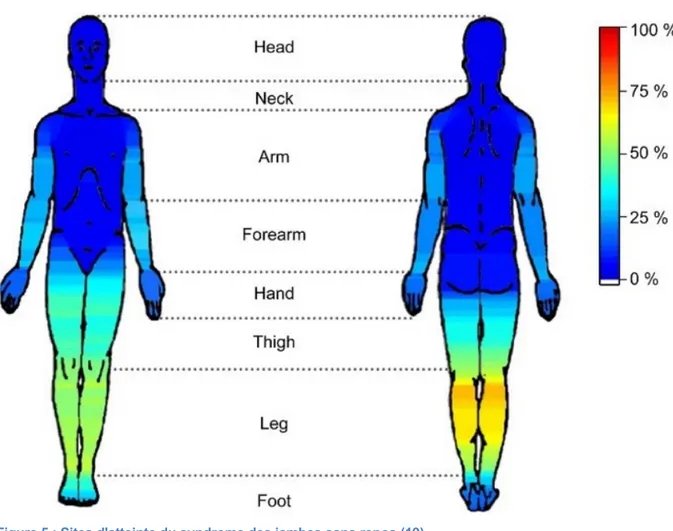 Figure 5 : Sites d'atteinte du syndrome des jambes sans repos (19) 