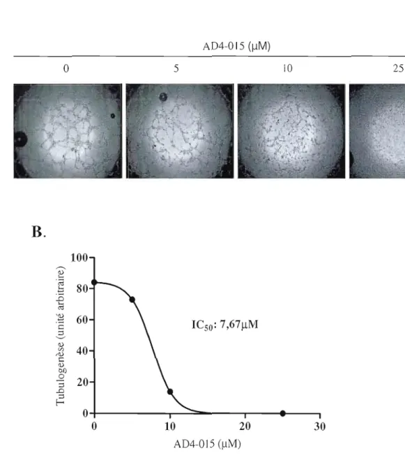 Figure  8 :  Inhibition  dose-dépendante  de  la  tubulogenèse  des  HBMEC  sur  matrigel  par  le  traitement des cellules avec  un  analogue de  la  mumbaïstatine  (n  =  J)