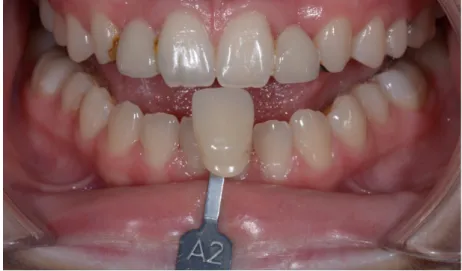 Figure 4: Courtoisie du Dr L. Lesieur 