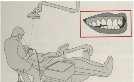 Figure 11: Vision à 12 heures [51] 