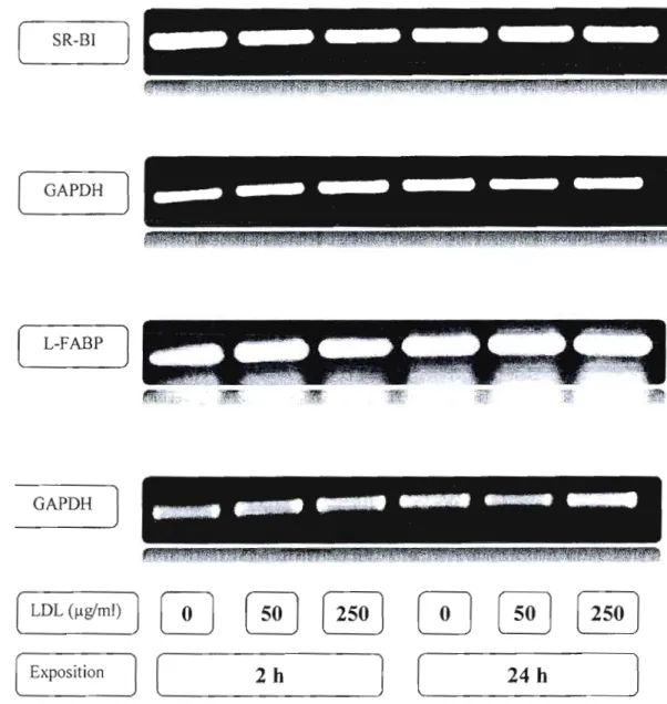 Figure 1:  RT-PCR  des  ARNm  de  SR-BI  et de  la  L-FABP  après  une  exposition  de  cellules  HepG2  à  des  LDL
