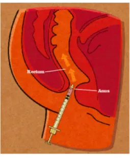 Figure 9 :  Le plug (23) 