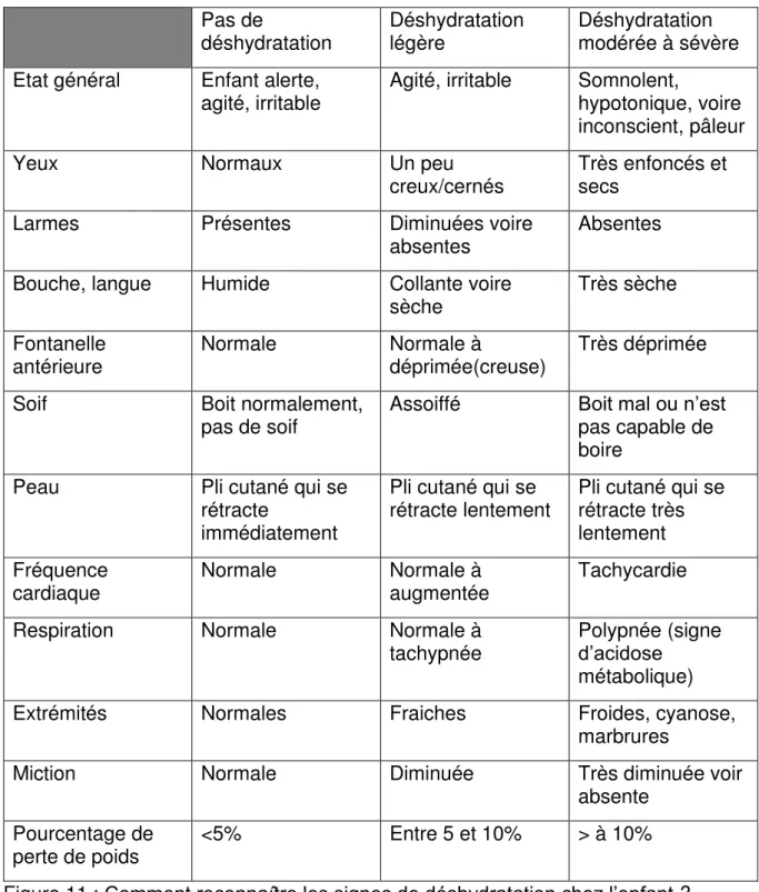 Figure 11  : Comment reconnaître les signes de déshydratation chez l’enfant ?  L’intensité de la déshydratation doit permettre de savoir : 