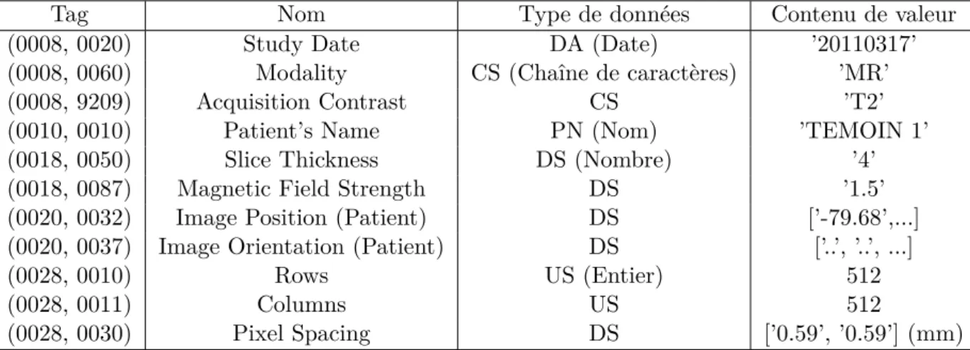Table 1.2 – Tableau récapitulatif de certains éléments extraits d’un fichier DICOM (Digital imaging and communications in medicine) permettant de retrouver les informations présentées dans la section 1.2.2 : la modalité d’acquisition, la patiente, l’orient