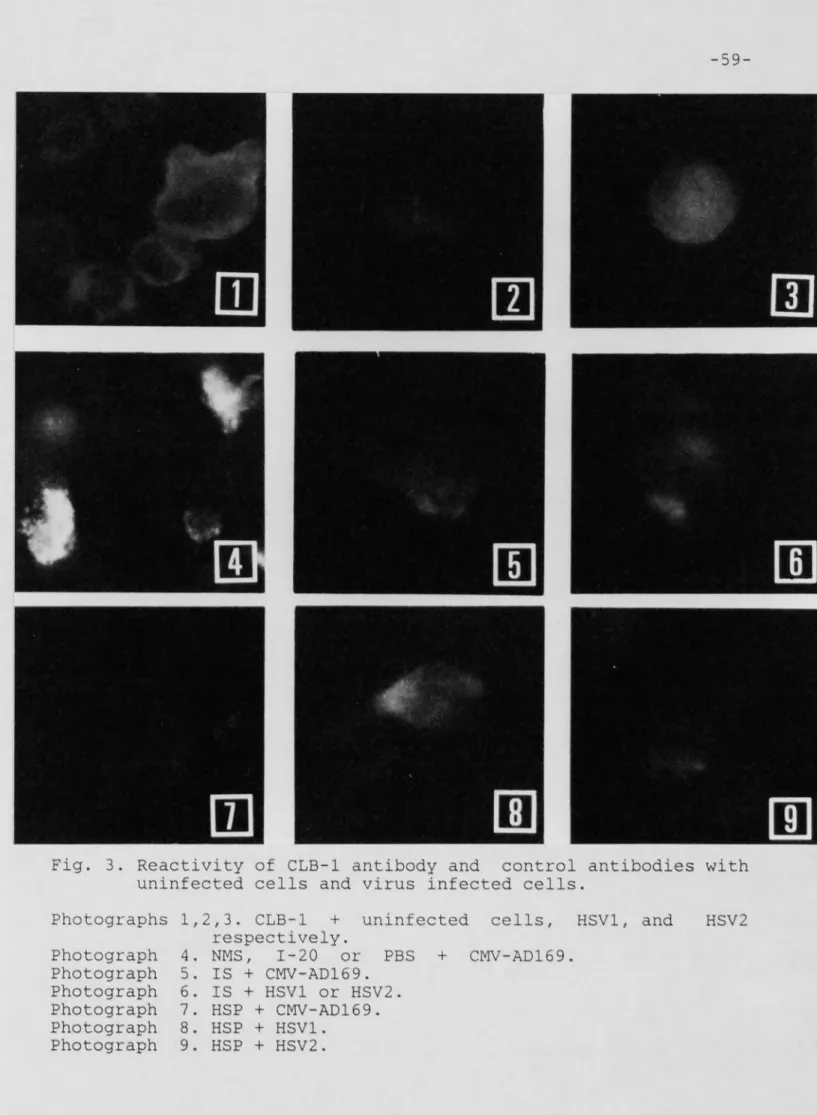 Fig. 3. Reactivity of CLB-1 antibody and control antibodies with  uninfected cells and virus infected cells.