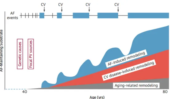 Figure  3 :  Histoire  naturelle  de  la  FA  et  de  la  cardiomyopathie  atriale,  d’après  Guichard et al (25)
