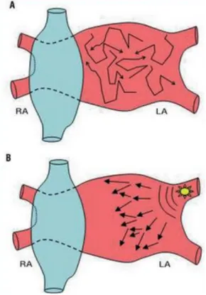 Figure  6 :  Schématisation  des  mécanismes  électrophysiologiques  de  la  FA.  A :  réentrées  (multiples  vaguelettes) ;  B :  foyers  d’automatisme  veineux ;  C :  foyers  d’automatisme  veineux associés aux phénomènes de réentrée (multiples vaguelet