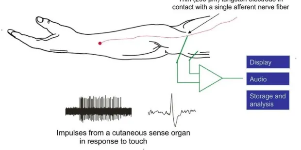 Figure 1-4: The microneurographic technique. An electrode is implanted into the nervous nerve bundle to find a single  afferent [7]
