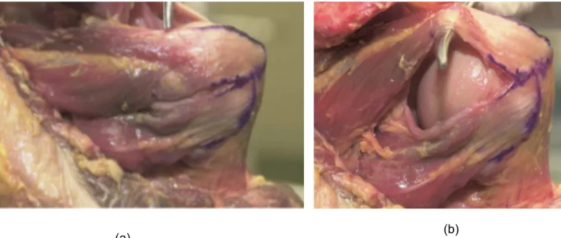 Figure 3 : (a) Vue postérieure de l’épaule montrant l’infraspinatus et le teres minor insérés 