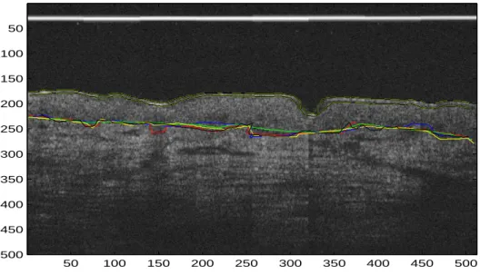 Fig. 3.3 – D´elimitation manuelle du stratum corneum et reste de l’´epiderme d’une image par cinq experts.