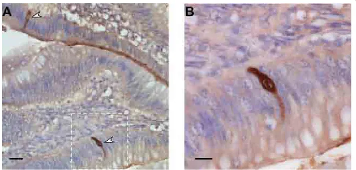 Figure 2 Subcellular localization of NS1 in duck ileal epithelial cells in vivo. A) Ileum collected 6 days post-infection from a Pekin duck infected orally with 10 7 pfu of the 977 virus, formalin fixed, sectioned at 3 μm