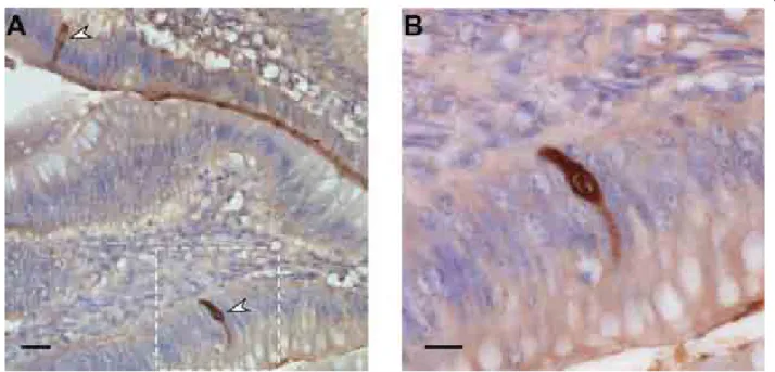Figure 2 Subcellular localization of NS1 in duck ileal epithelial cells in vivo. A) Ileum collected 6 days post-infection from a Pekin duck infected orally with 10 7 pfu of the 977 virus, formalin fixed, sectioned at 3 μm