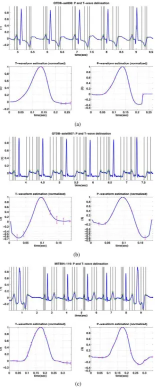 Fig. 8. Results of processing ECG datasets (a) “QTDB-sel808”, (b) “QTDB- “QTDB-sele0607,” and (c) “MITBIH-119”