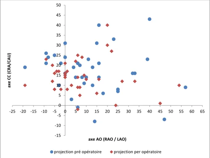 Figure 3 : Représentation des couples d’angulation déterminant les projections  pré et per opératoires pour notre population
