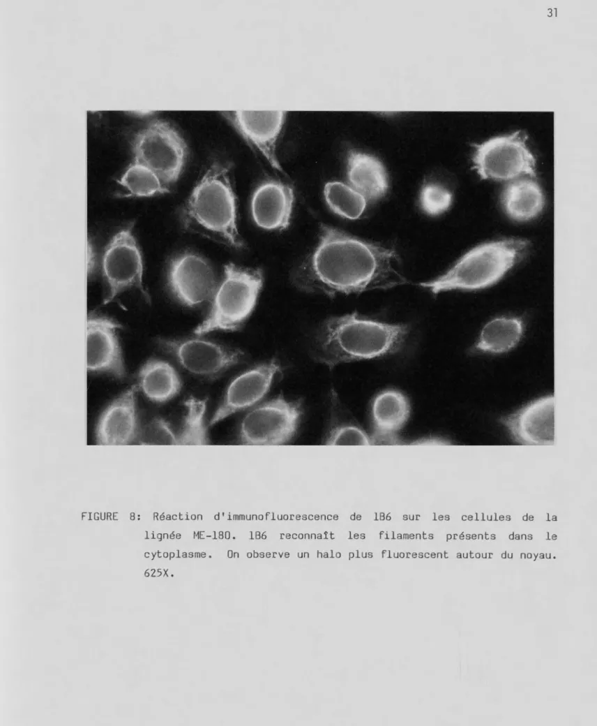 FIGURE 8: Réaction d1 immunofluorescence de 186 sur les cellules de la  lignée ME-180