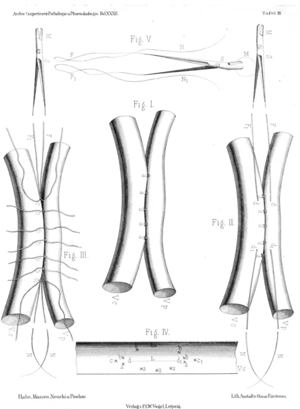 Figure n°1 – La fistule d’Eck. D’après Hahn (1893) [10]