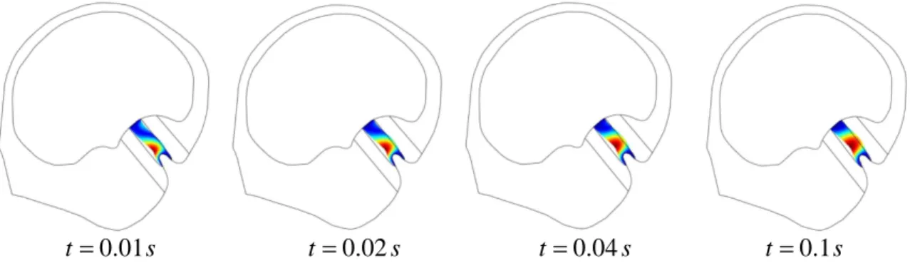 Figure  4.  Evolution  of  the  displacement  of  the  cupula  at  the  very  beginning  of  the  imposed  rotational  motion