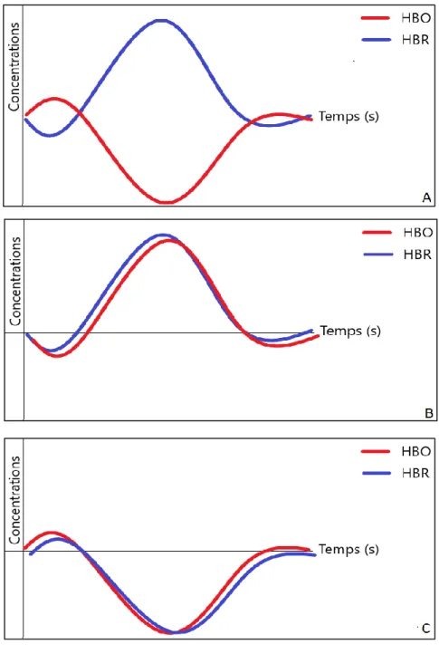 Figure 18 : Réponses Atypiques 