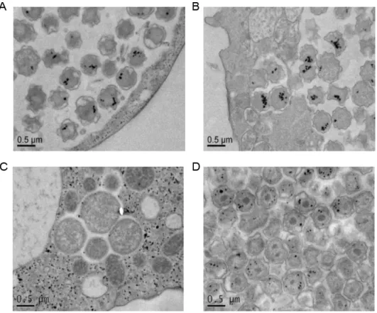 Figure  2:  Accumulation  of  glycogen  in  infected  Acanthamoeba  castellaniin  glycogen  was  observed  by  TEM  (Transmission  Electron  Microscopy)  after  PATAg  coloration  in  Estrella  lausanensis after 16h (A) and 24h of infection (B), and in Wad