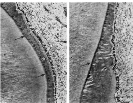 Figure 3 : coupe de dent centrée sur la dentine  réactionnelle [52]