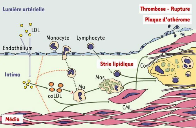 Figure 13 : Les différents étapes de la constitution de la strie lipidique et de la plaque  d’athérome (16) 