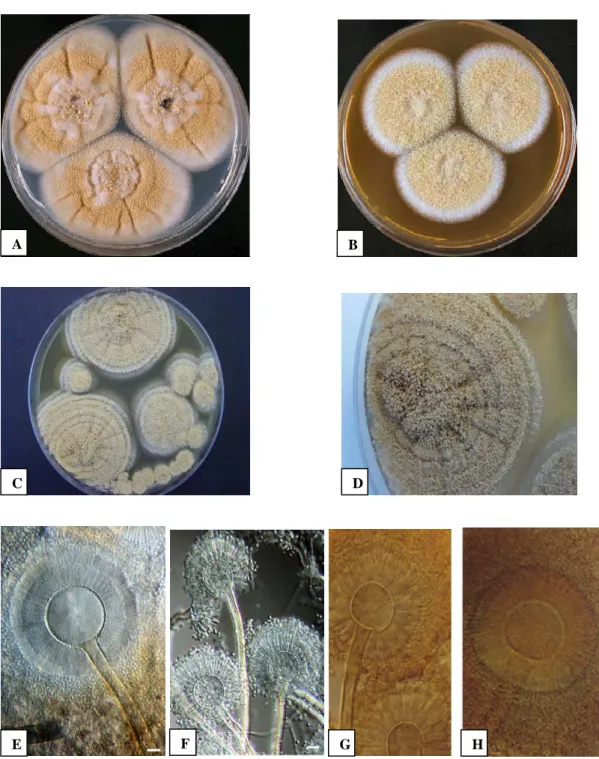 Figure 4. Aspergillus westerdijkiae after 7 days of incubation at 25 °C in CYA (A) and  MAE (B)