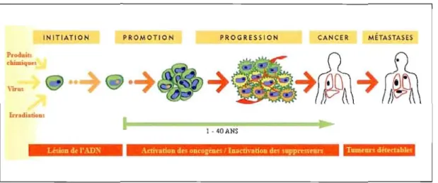Figure 1.2  : Étapes de l'évolution du cancer. 