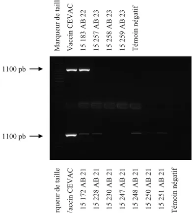 Figure 1 : Amplification par PCR d’une fraction du gène ompA de la culture 15 183 de la souche AB 22 et des  cultures 15 172, 15 228, 15 248 et 15 251 de la souche AB 21