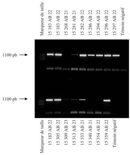 Figure 2 : Amplification par PCR d’une fraction du gène ompA des cultures 15 183, 15 282, 15 286, 15 294,  15 296, 15 297, 15 305 et 15 359 de la souche AB 22 et de la culture 15 333 de la souche AB 21