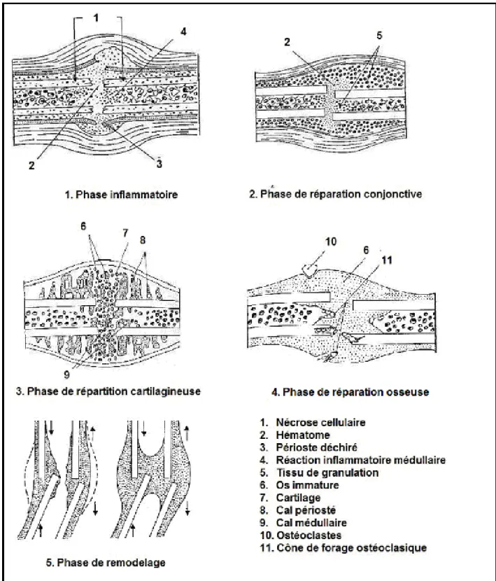 Figure 2 :  Evolution de la cicatrisation osseuse (3) 