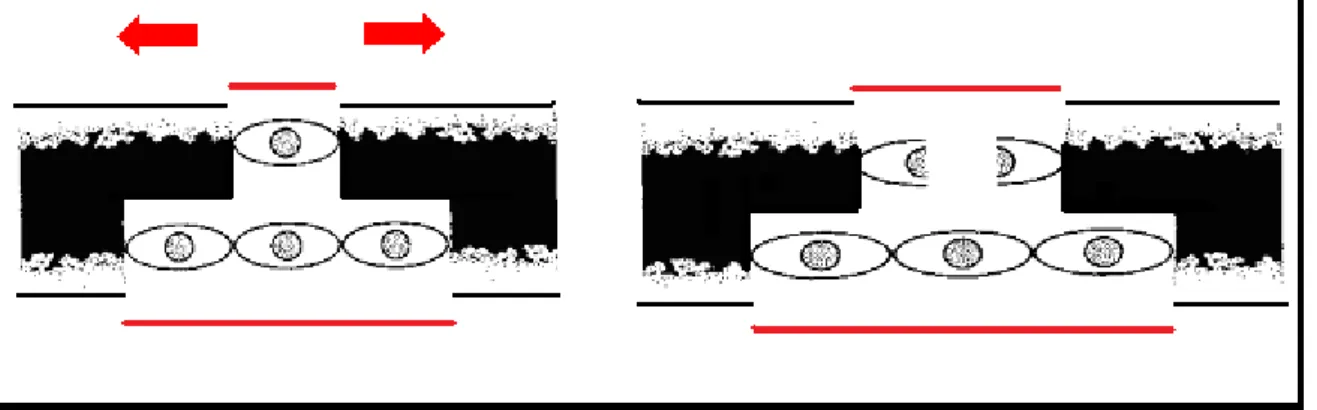 Figure 5 :  Concept de déformation inter-fragmentaire dans un trait de fracture (18) 