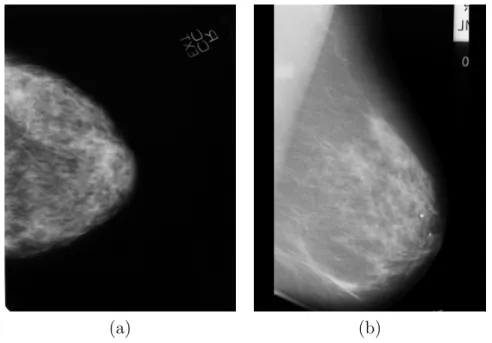 Figure 2.6: Mammographic images obtained under different projection angles of the X-rays system