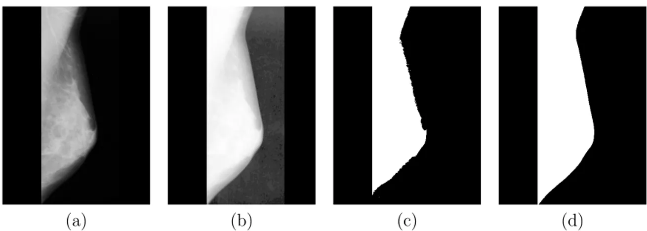 Figure 3.4: Segmentation of breast region in mammogram using a global thresholding. (a) Initial image, (b) logarithmic enhanced image, (c) initial image segmentation, (d) Enhanced image segmentation