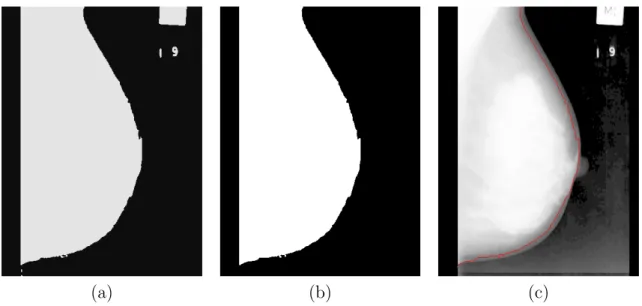 Figure 3.8: Inaccurate foreground region segmentation using FCM method (a) Image seg- seg-mentation result: breast and muscle tissue region and examination notes are assigned to the foreground class, (b) foreground region obtained after suppression of non 