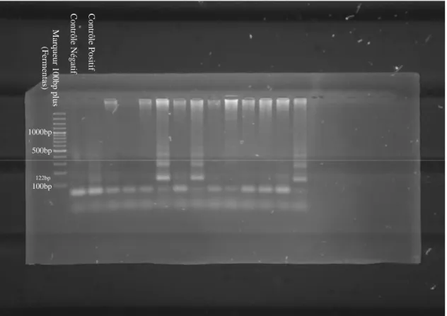 Fig.  18:  Gel  d'électrophorèse  des  produits  de  PCR  obtenus  avec  les  amorces  TEPAN  sur  des  échantillons de terrain de bovins 